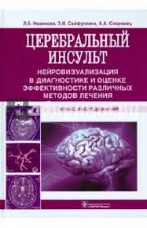 Церебральный инсульт Атлас исследований Пособие Новикова